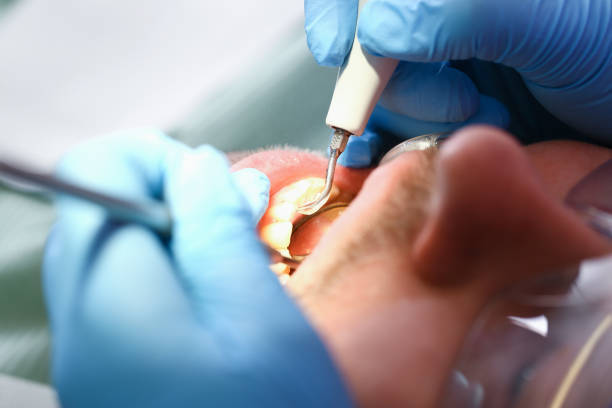 Best Emergency Treatment for Dental Infections or Abscesses in Combined Locks, WI