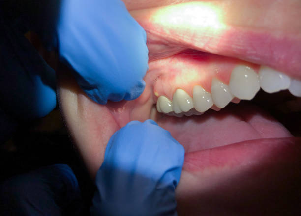 Best Emergency TMJ Treatment in Combined Locks, WI