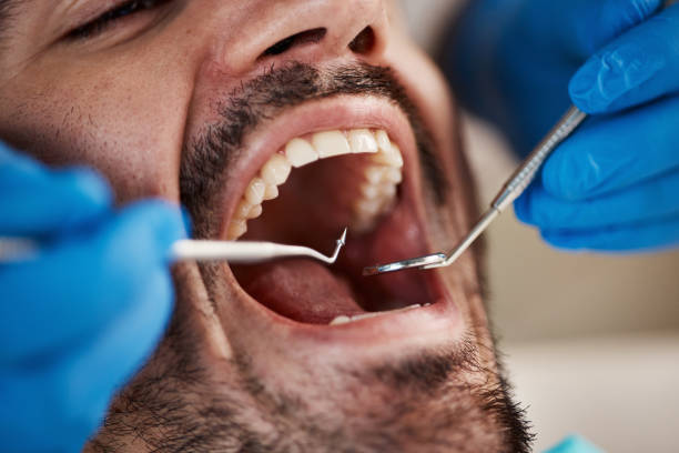 Best Urgent Care for Lost Fillings or Crowns in Combined Locks, WI